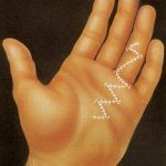 dupuytren cirugia mano extremidad superior cirugia plastica reconstructiva reconstruccion mano brazo