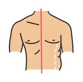 liposucción lipoescultura hombre cirugia plastica estetica sevilla