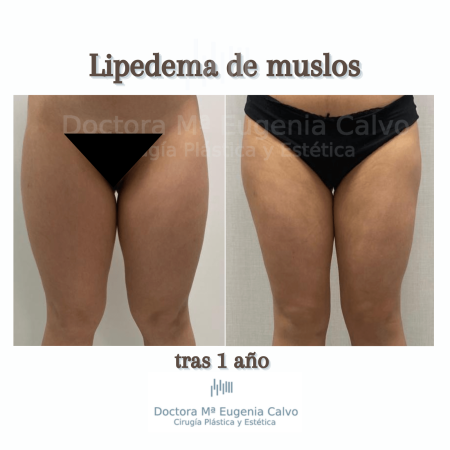 lado (3)